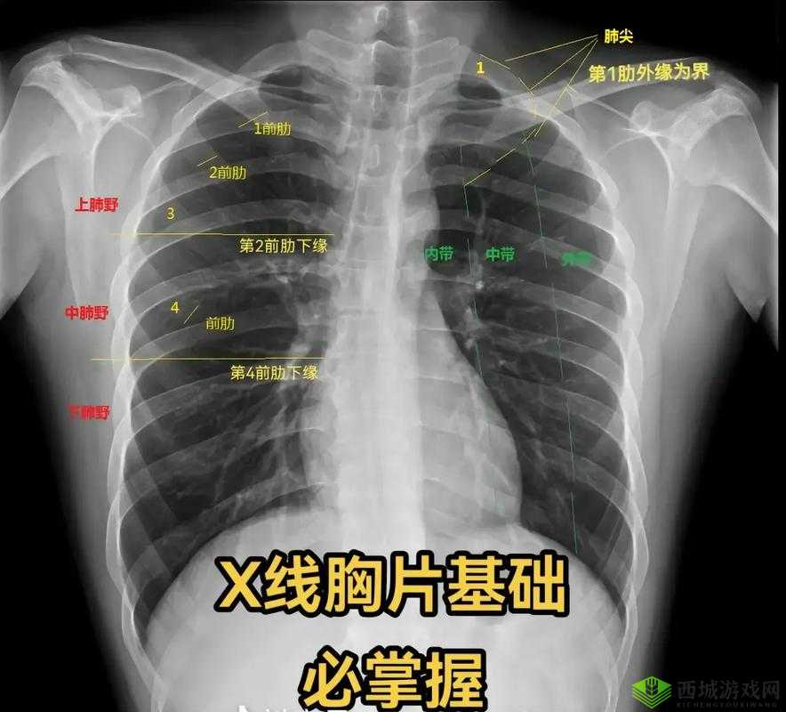 十大曝光胸片平台：揭示医疗影像背后的真相与警示