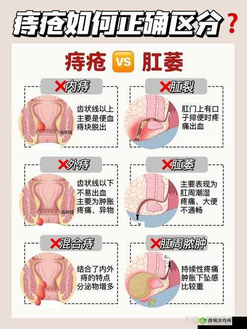 肛门口有个肉球突出是怎么回事：原因分析与应对方法探讨