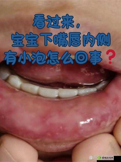 宝宝下面湿透了还嘴硬疼的原因究竟是什么引起的呢