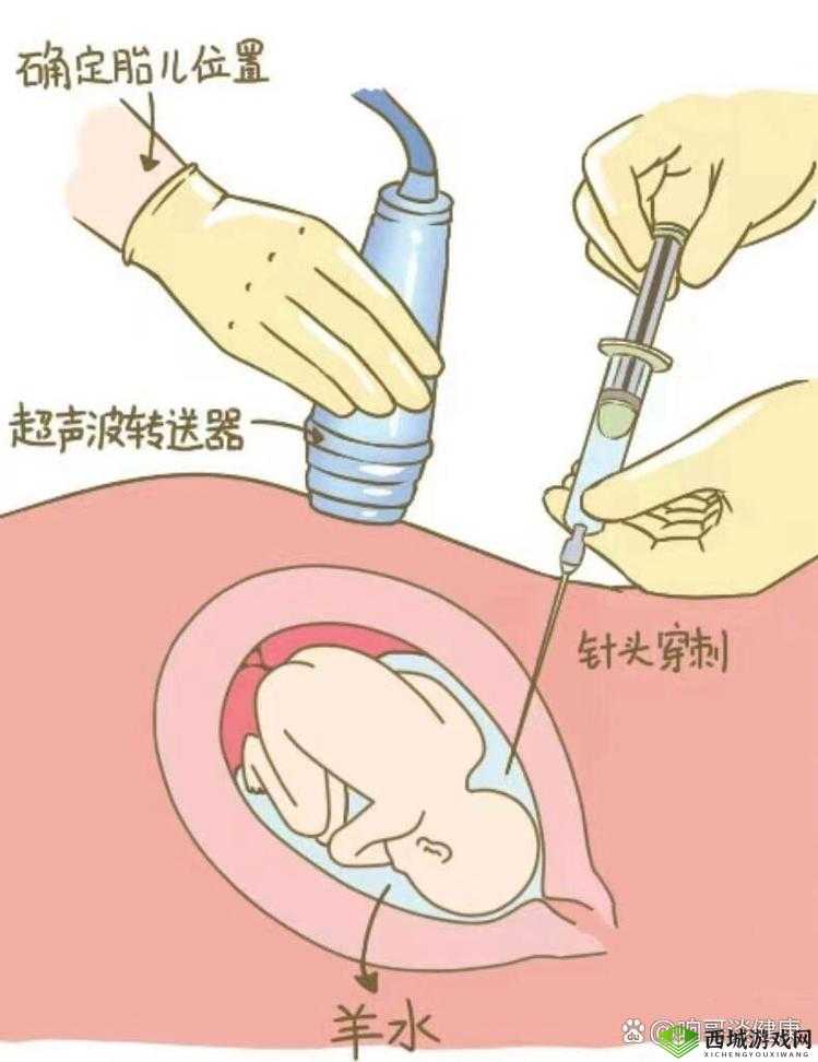 如何正确进行日羊插羊水门操作？